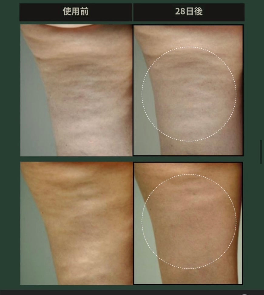 【特典付き🎁】【SUELO】 VOLCANO BODY SLIMMING PPC CREAM 120ml  (マッサージクリーム) 　※7/8〜7/19迄に順次発送予定